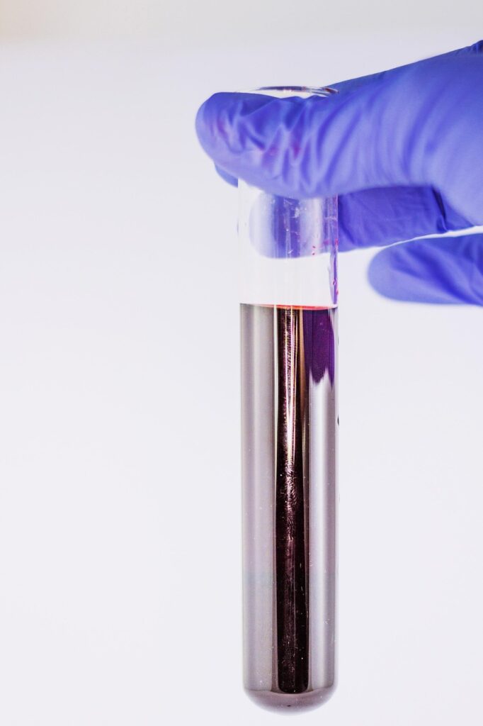 medical, trials, test tube, diagnostics, lab, glove, rubber, hospital, test, diagnosis, diagnostician, download