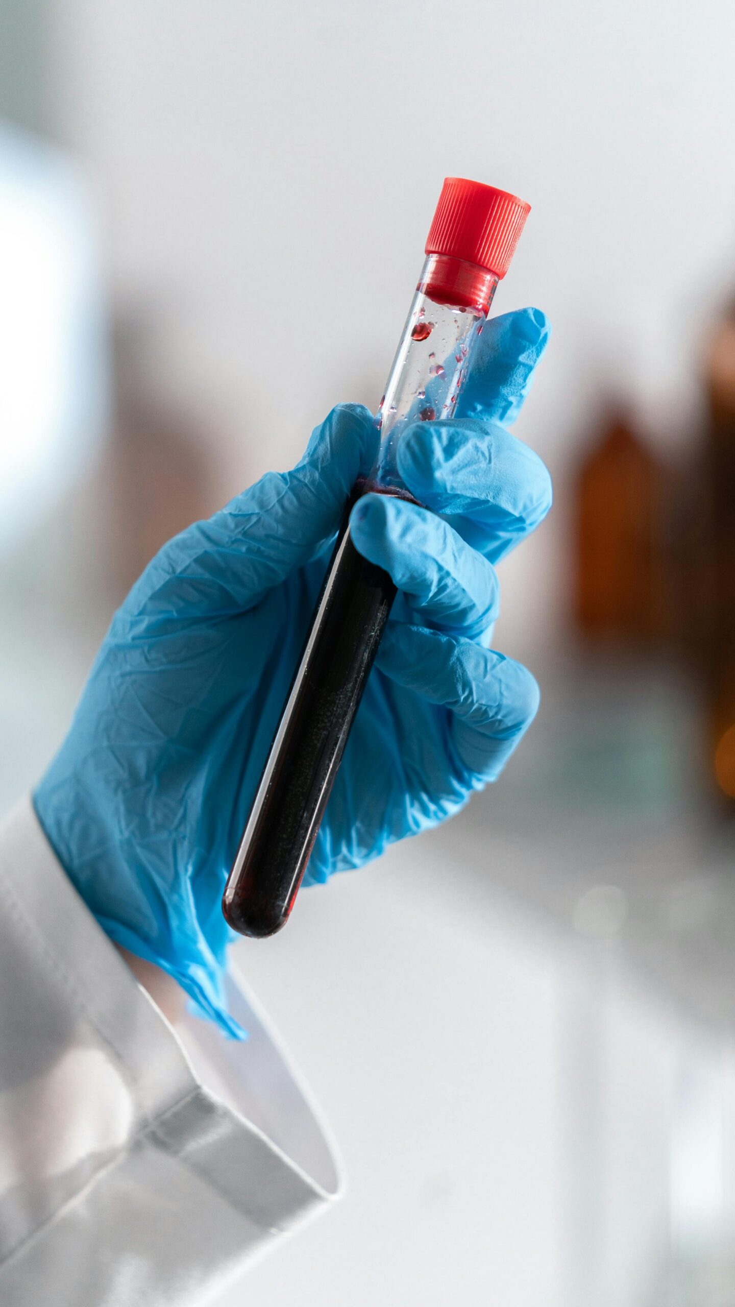 Close-up of a gloved hand holding a blood sample in a laboratory setting.